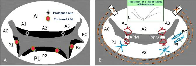 Figure 3 A&B