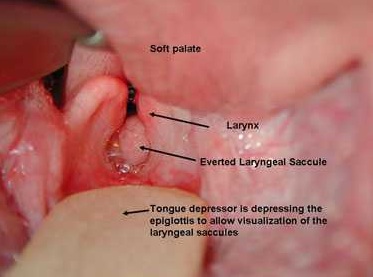 Sinus And Palate Pressure