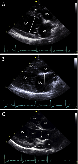 Long-Axis Echo Measurements