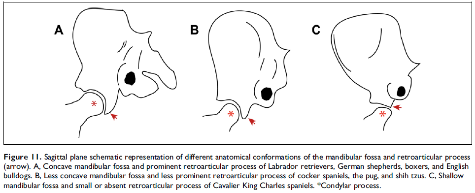 Comparison of TMJs