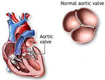 Aortic Valve