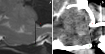 Comparison of MRI and CT scans