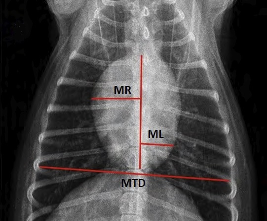 Cardiothoracic Ratio measurements