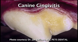 Gingivitis