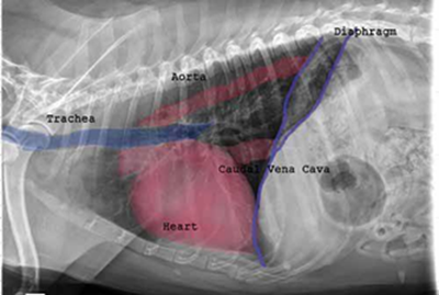 X-ray of heart