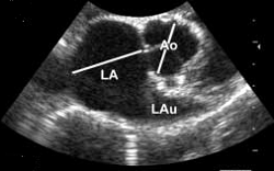 LA/Ao measurements