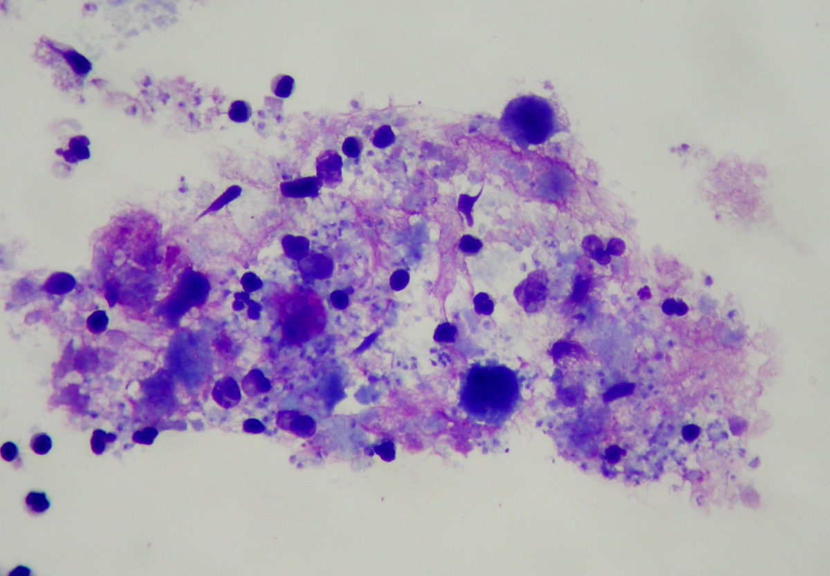 Pneumocystis