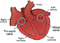 Tricuspid Valve